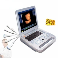 medical 3d ultrasound laptop equipment ultrasonic scaler ultrasound machine