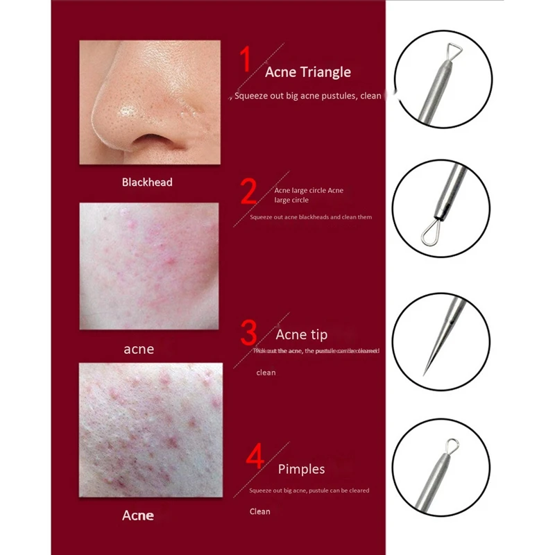 Acne Nose Blackhead Remover White Head Tool Pimple Removal Needle | Красота и здоровье