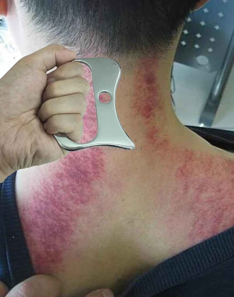 Массажер гуаша из нержавеющей стали скребок для физиотерапии Аппарат Для