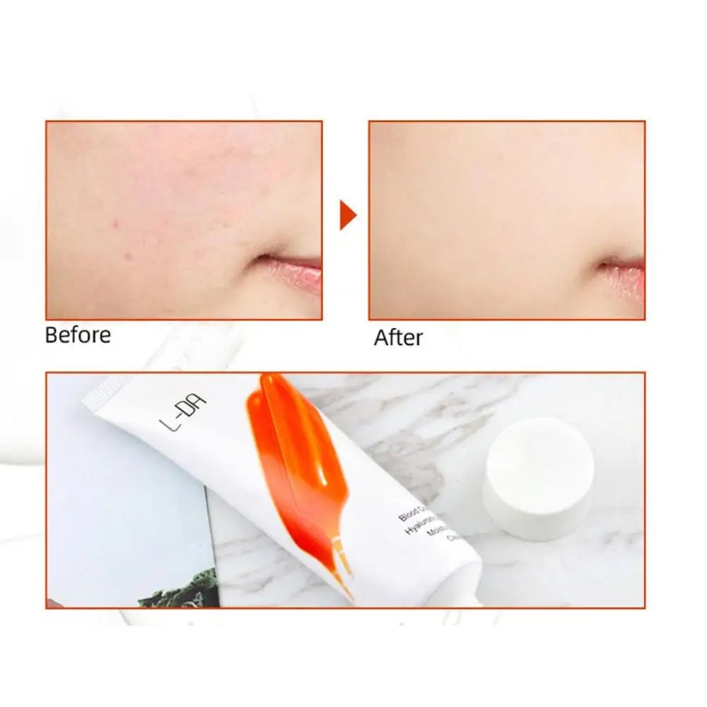 80 г отбеливающая молочная пена для лица L-DA оранжевая эссенция крови отбеливания