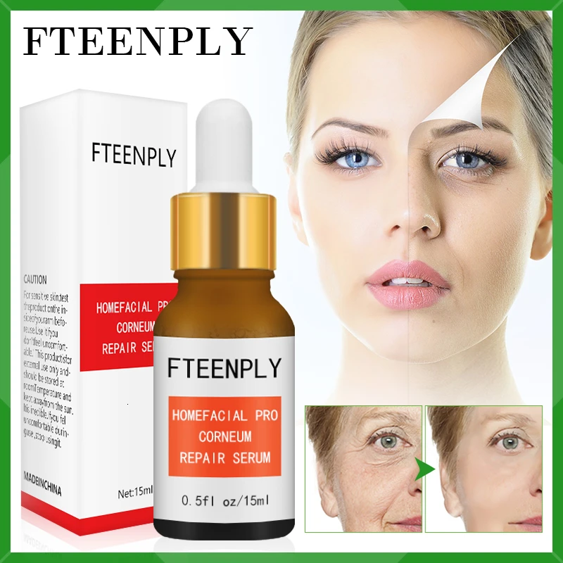 FTEENPLY никотинамид Сыворотки уход за лицом отбеливание и осветление гиалуроновой