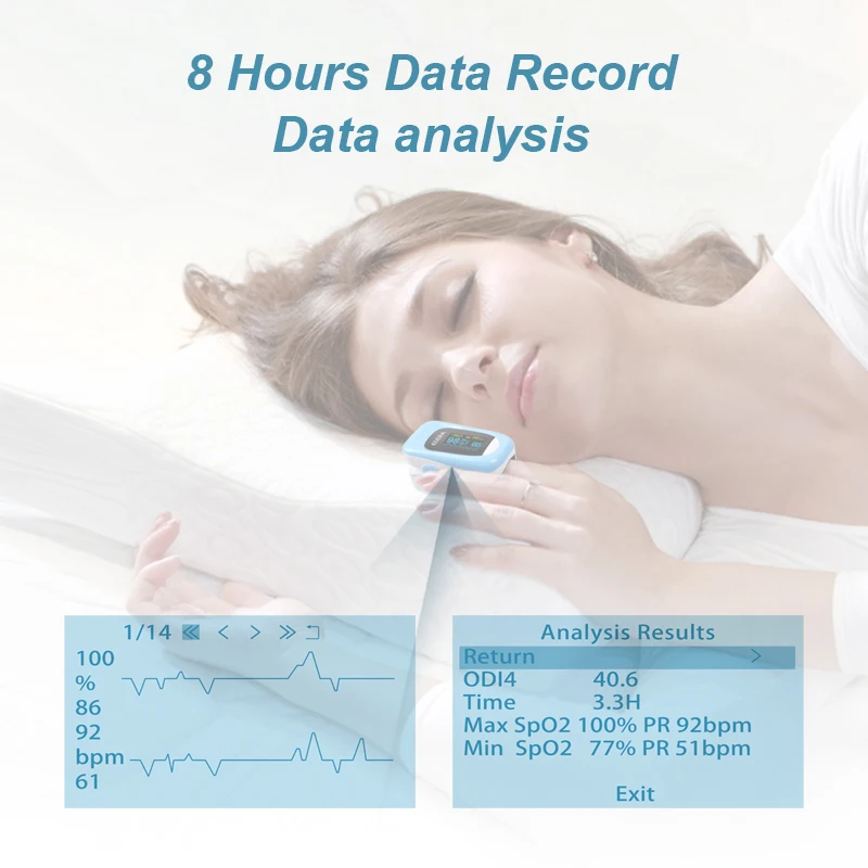 Пульсоксиметр Пальчиковый ELERA SPO2 PR PI ODI4 4 параметра 8 часов мониторинга сна |