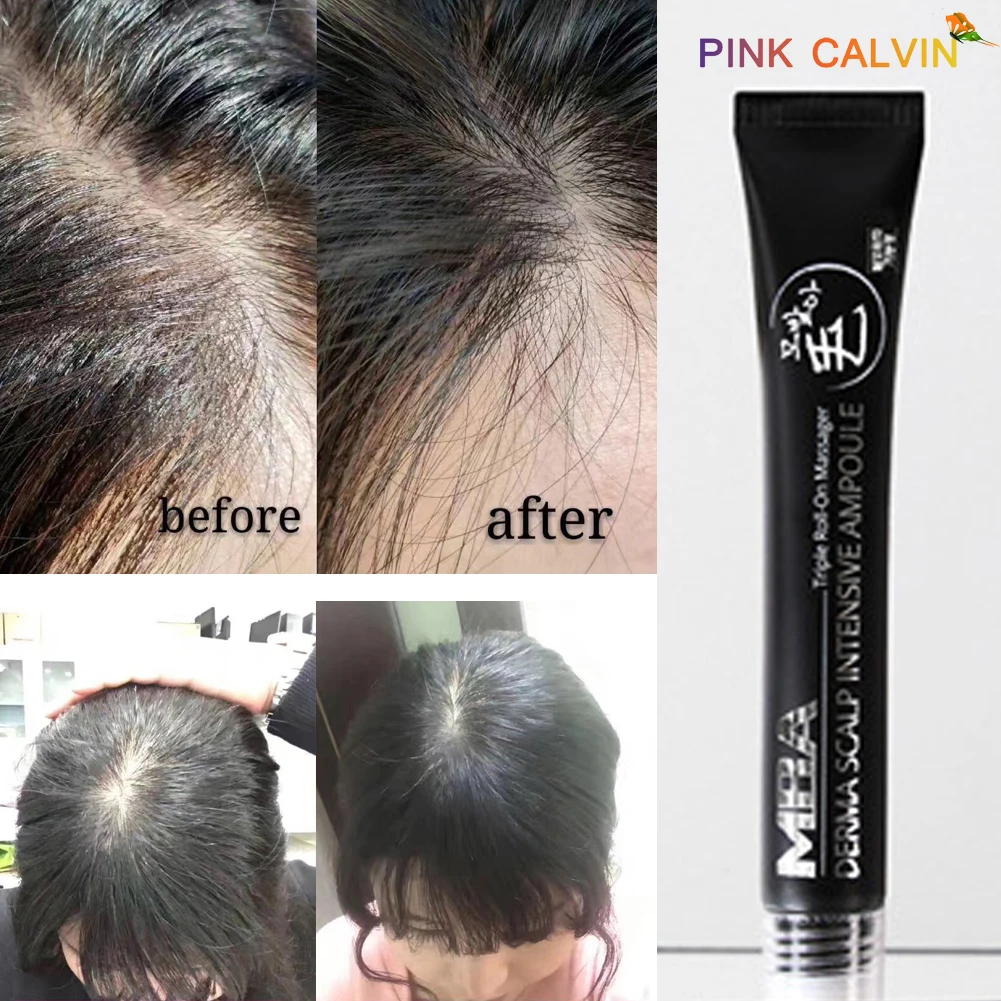 Эфирное масло против выпадения волос для мужчин и женщин средство ухода за