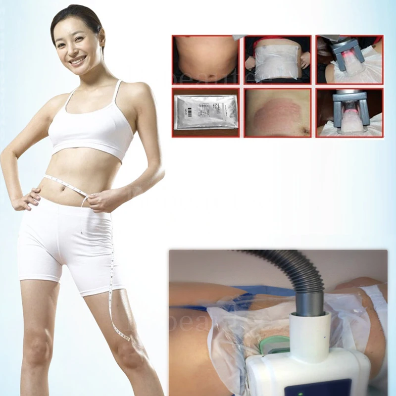 5 шт. антифриз фильмтек Дов Ро) Cryolipolysis для незамерзающей жидкости крио терапия Pad