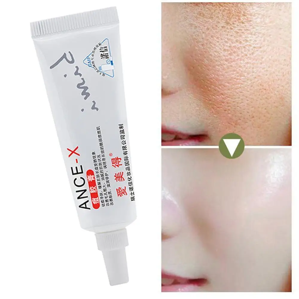 15 г лечение шрамов крем для лица акне на лице шрам средство удаления растяжек