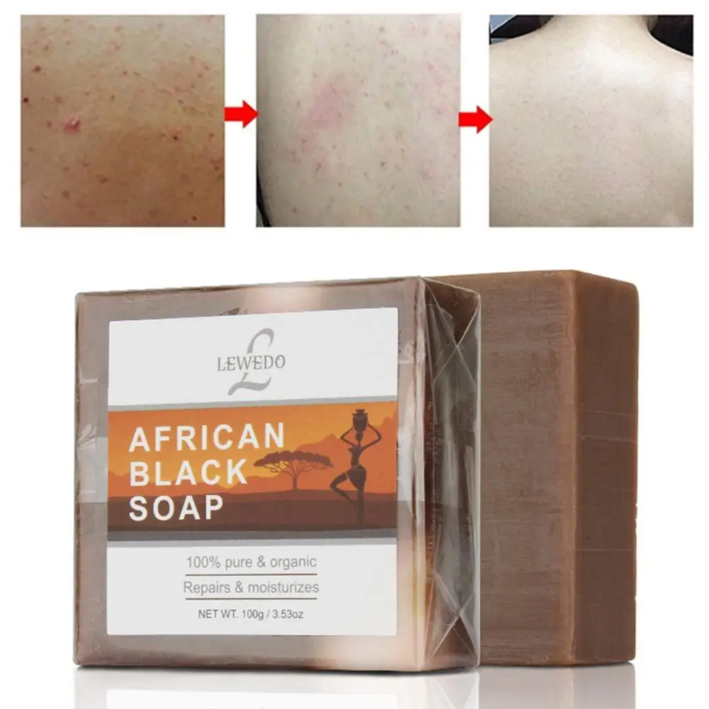 

African Natural Black Soap Antibacterial Whitening Skin Care Soap Face Acne Skin Soap Body Treatment T7W7