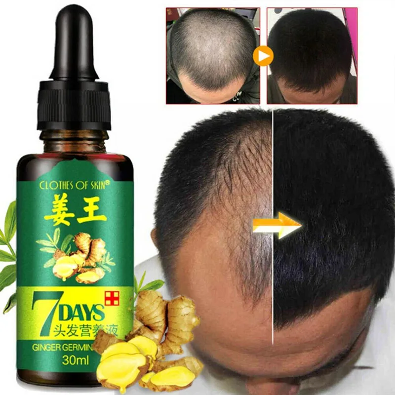 

Ginger Hair Growth Essence 7 Days Germinal Hair Growth Serum Essence Oil Hair Loss Treatment Growth Hair for Men and Women