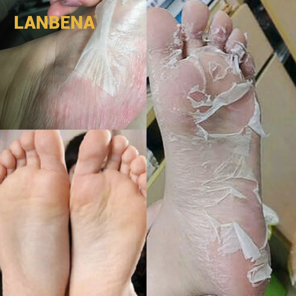 LANBENA маска для ног Уход за ногами пилинг для ног отшелушивающие носки Отшелушивание для ног носки для педикюра маска для ног Крем для ног