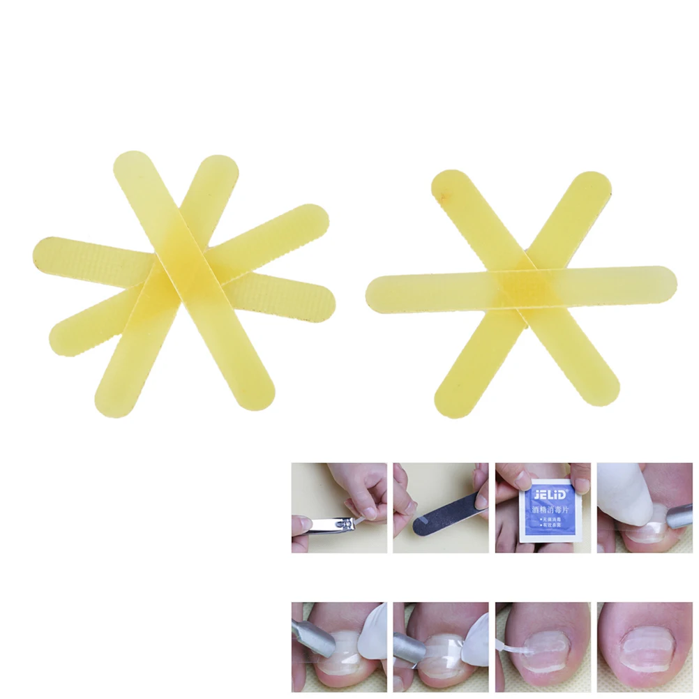 

1Pc Ingrown Toe Nail Correction Sticker Patch Paronychia Correction File Acronyx Wire Corrector Foot Care Tool