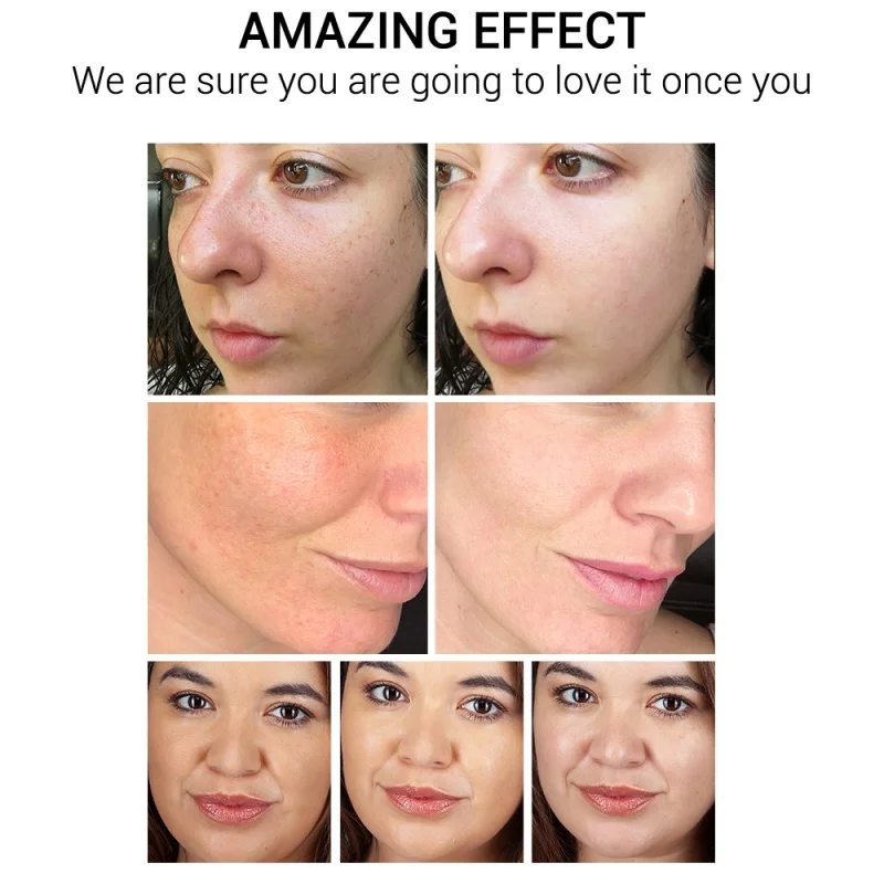 

Face Cream Vitamin C Whitening Nourish Brighten Remove Freckle Improving Dull Skin Anti Aging Refreshing Not Greasy 50g