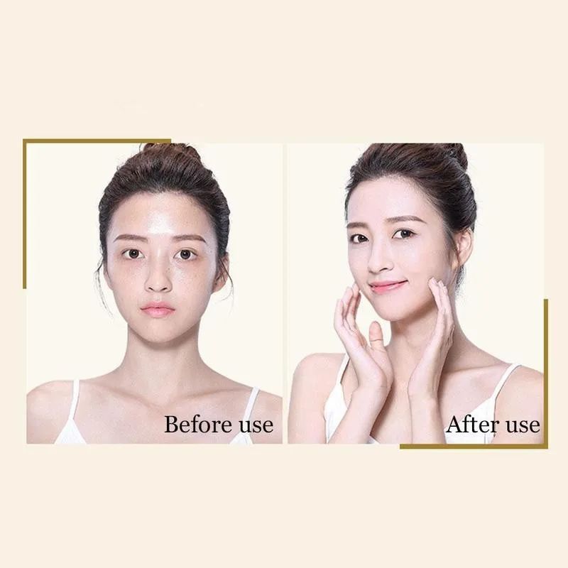 

40ml Hyaluronic Acid Anti Face Serumniacinamide Minimizer Extract Firm Pore Moisturizing Aging Skin Care Collagen H3I6