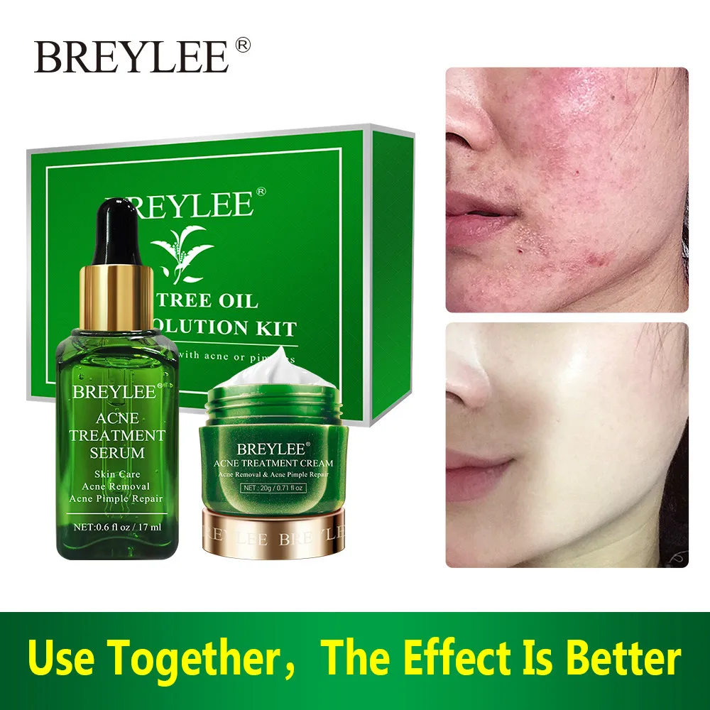 

BREYLEE Acne Treatment Serum Cream Mask Acne Solution Kit Spots Pimple Removal Essence Anti Acne Skin Care Face Facial Serum