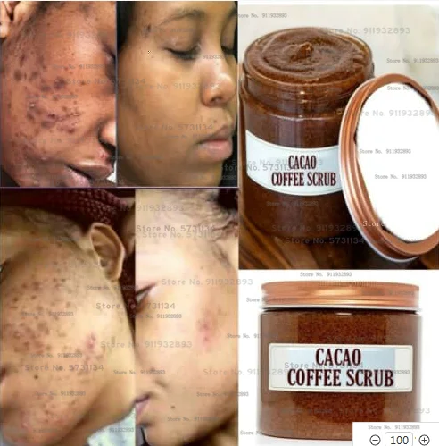 

Coffee scrub, Cacao Scrub, Acne , Dark Spots Remover, Cellulites, Even Skin