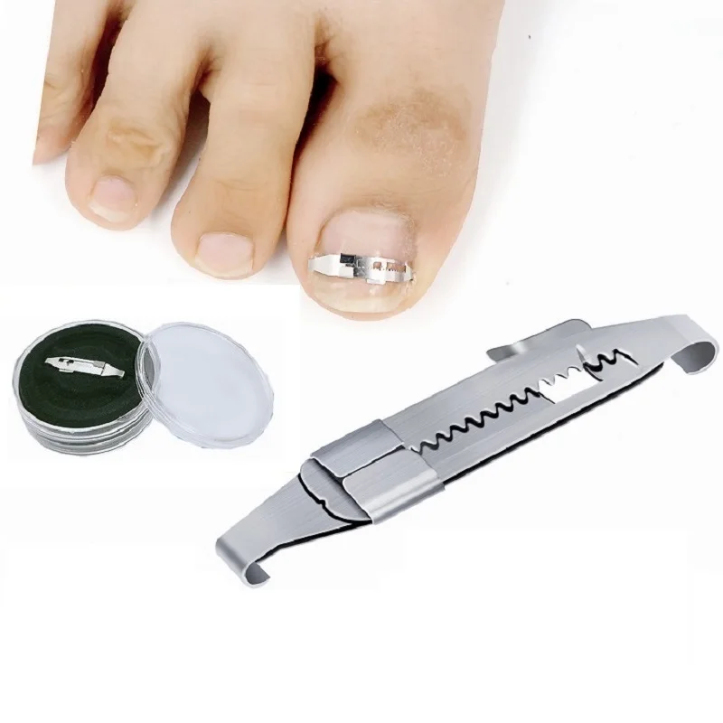 Инструмент для педикюра с вросшим ногтем профессиональное восстановление