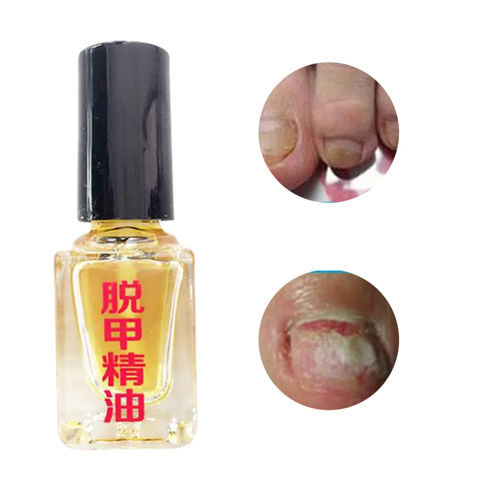 

5ml Fungus Removal Essence Liquid Fungal Nail Treatment 3 Days Effect Bright Nail Repair Anti Infection Foot Caring Plasters