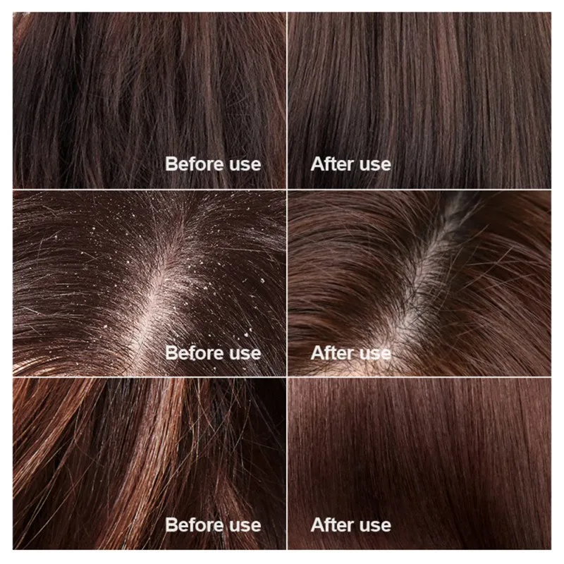 Шампунь с морской солью средство для борьбы перхотью снимает зуд уменьшает