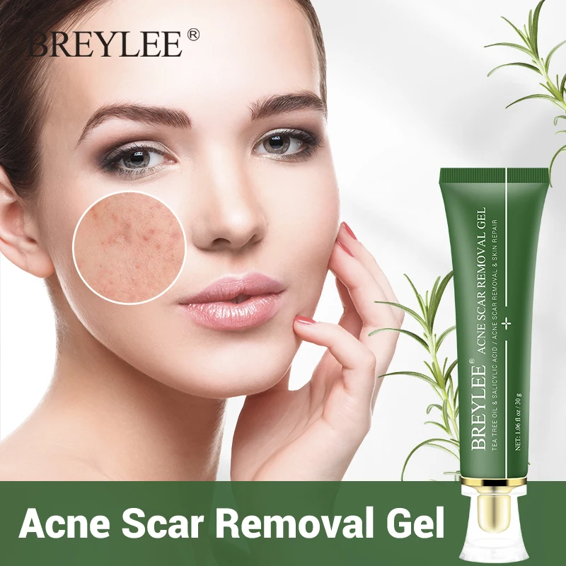 

BREYLEE Acne Scar Removal Gel Fade Acne Marks Spots Remove Skin Pigmentation Soothing Prevent Acne Treatment Serum Essence 30g