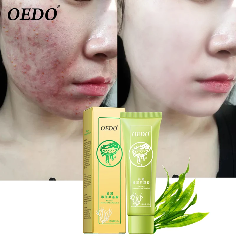 

OEDO Seaweed Aloe Vera Gel Hydrating Whitening Day Creams Acne Anti Aging Wrinkle Collagen Whitening Facial Cream Brighten Skin