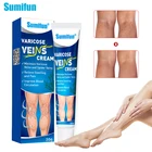 Крем для лечения варикозного расширения вен Sumifun, мазь для облегчения боли в ногах