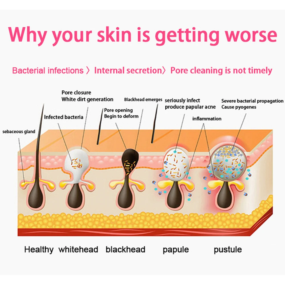 Электрическая мини-Массажная ультразвуковая щетка из инструмент для чистки лица