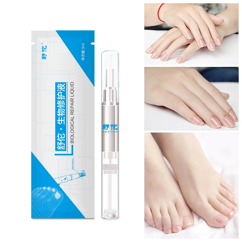 

Nail care solution to remove onychomycosis special drug biofilm removal of onychomycosis antibacterial solution nail care tools