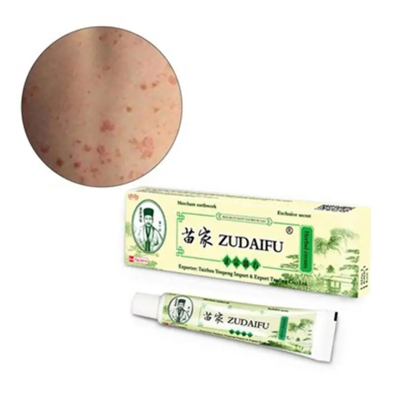 ZUDAIFU кожу крем от псориаза травяной крем от псориаза Антибактериальный Dermatiti Eczematoid по уходу за кожей