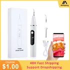 Визуальный зубной скалер пятна зубного камня для удаления зубного камня очиститель зубов машина для очистки зубов профессиональный ультразвуковой очиститель зубов