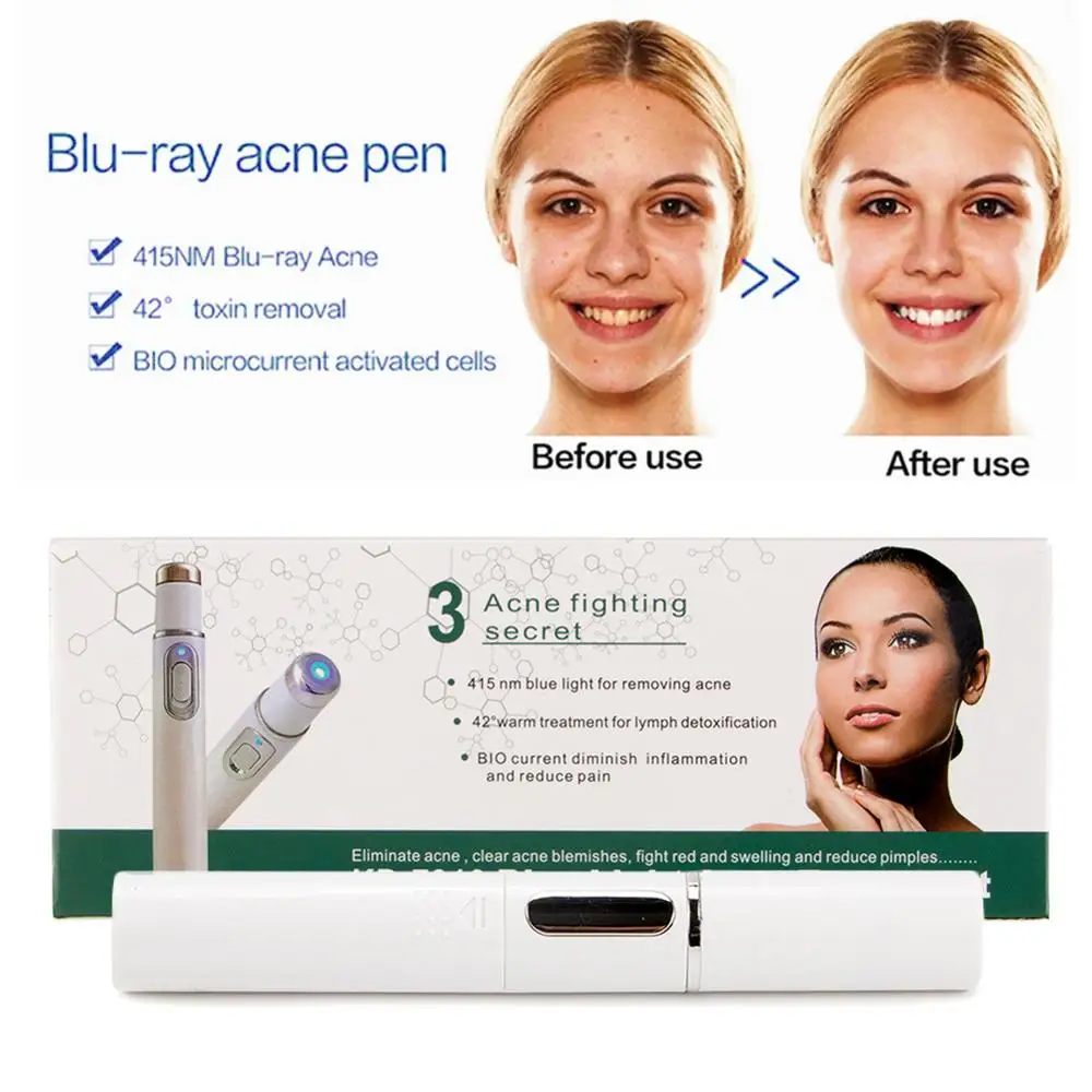 Акне лазерная ручка удаление морщин машина Портативный прочный синий светильник