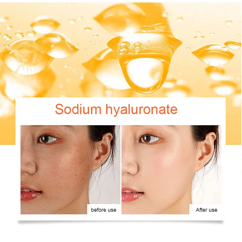 

Wholesale Instant Blemish Removal Gel Freckle Vitamin C Remove Whitening Anti-Wrinkle Freckle Cream Pen Moisturizing Essence M3