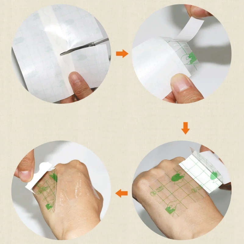 

Fixing Bandage PU Waterproof Dressing Roll Cream Transparent Medicated Tapes Medical Waterproof Wound Care Dressing