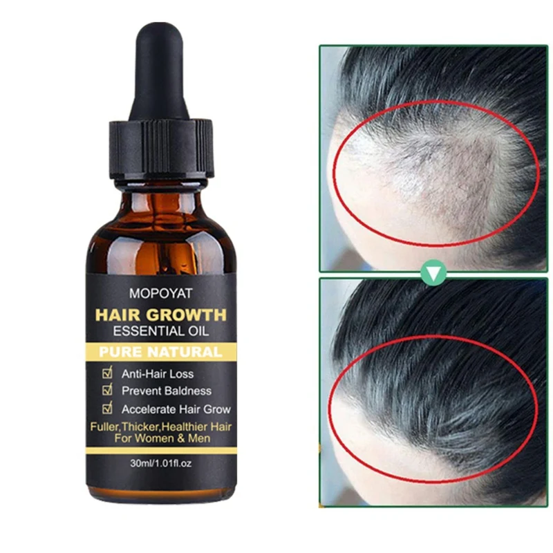

30ml Hair Growth Essential Oil Repair Damage Hair Growth Treatment Thick Root Repair Dry Anti Hair Loss Essence