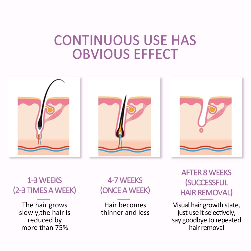 Домашний депилятор лазерный мини-эпилятор система IPL для постоянного удаления