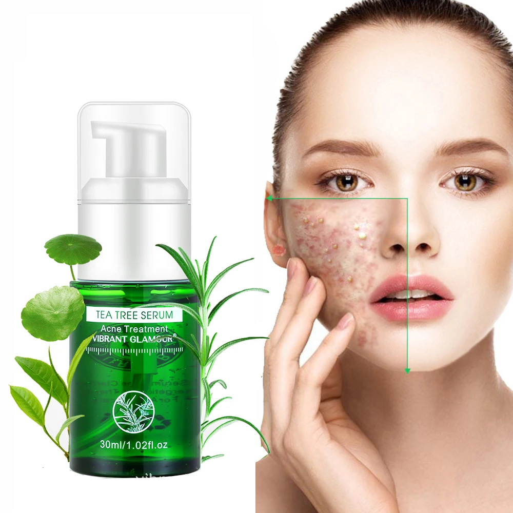 

Tea Tree Acne Eliminating Essence Acne Treatment Oil Control Shrink Pores Soothes Sensitive Skin Face Care Skin Care Serum 30ml