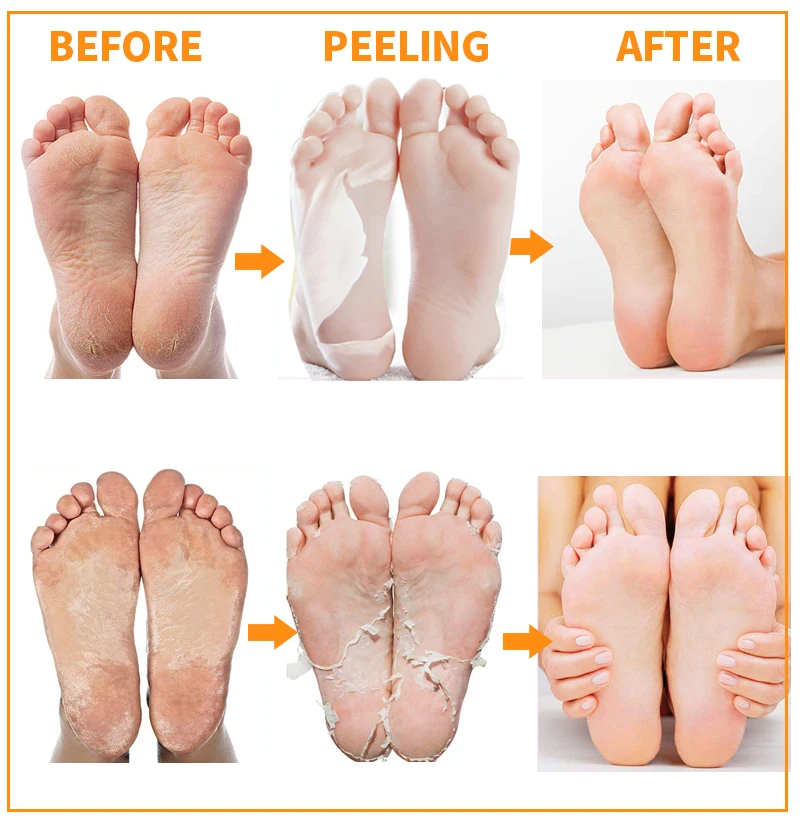 EFERO оранжевый Отшелушивающий маска для ног педикюра носки Питательный Уход за