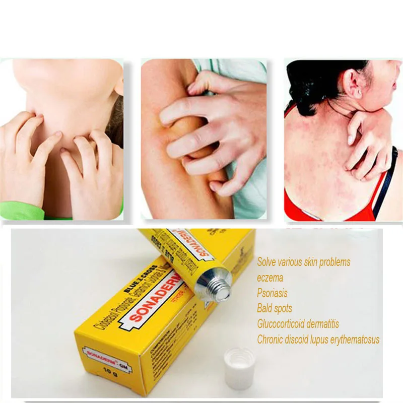 

India Small yellow cream SONADERM-GM ointment to remove folliculitis, alopecia areata, e czema,skin problems 10g * 2box