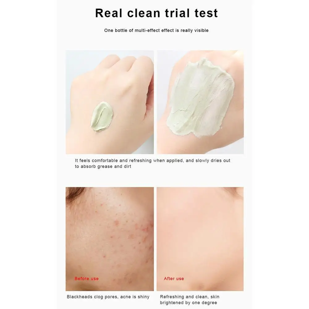 Green Tea Ice Muscle Mud Mask Anti-acne Face Cream Blackheads Acne Essence Removal Pores Cream Scar Shrink Care Skin G6M0
