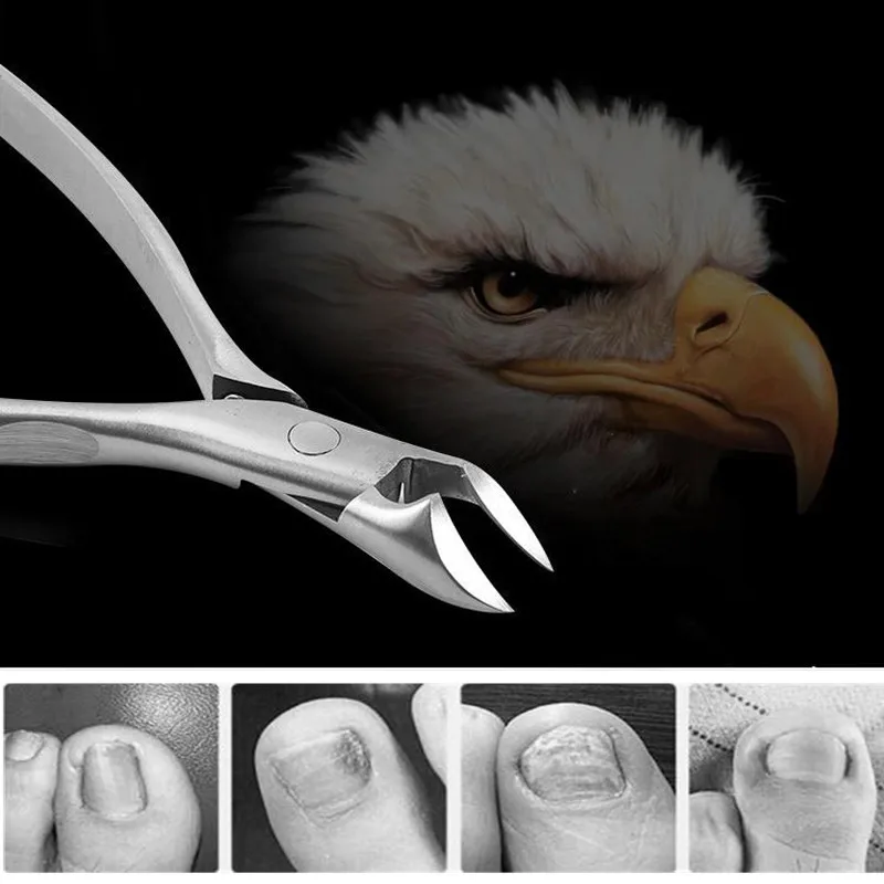 Кусачки для ногтей из нержавеющей стали триммер вросший педикюр уход