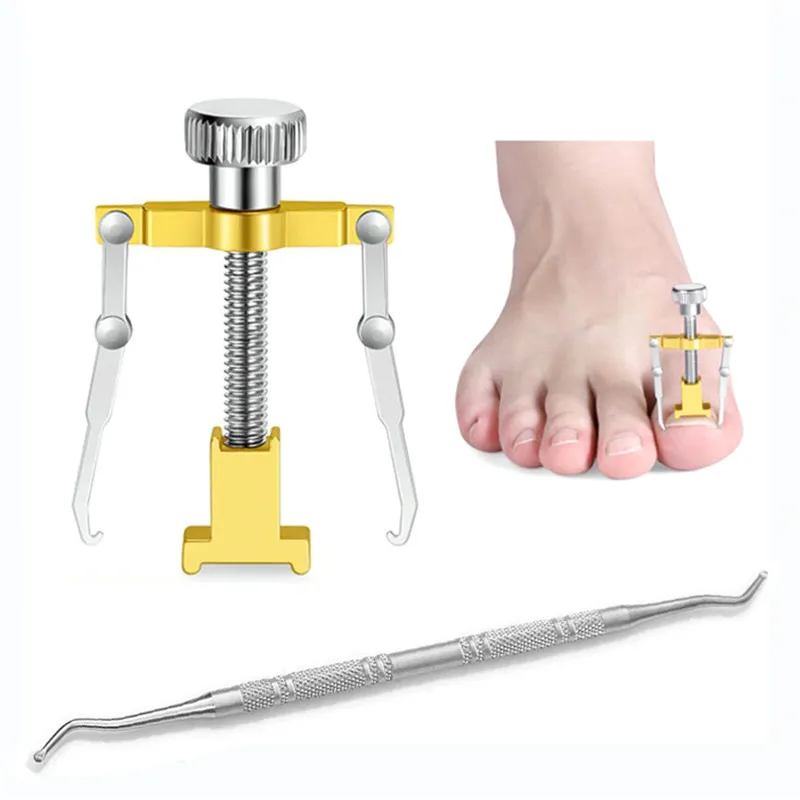 

2pcs/set Professional Effective Treatment Ingrown Toenail Correction Pedicure Tools Paronychia Foot Care Nail Recover Tools