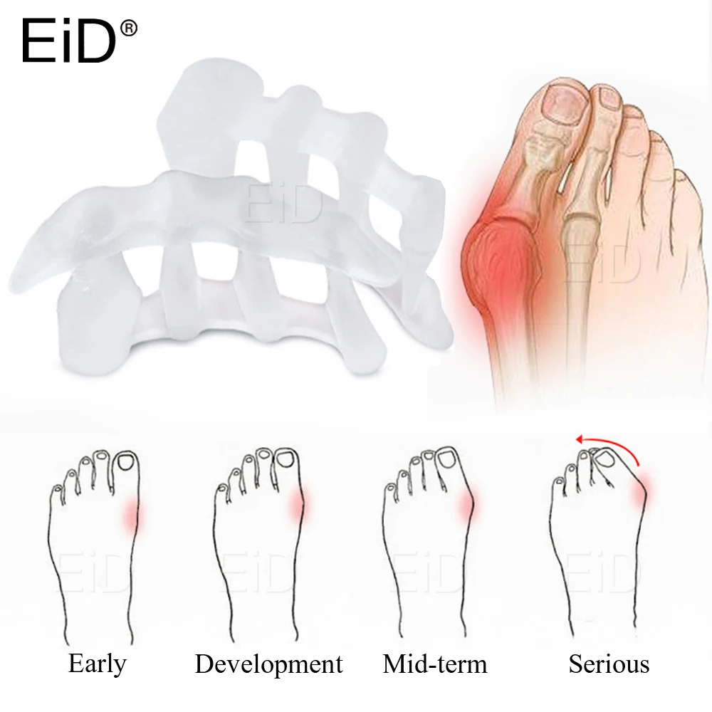 Ортопедический силиконовый разделитель для пальцев ног при вальгусной