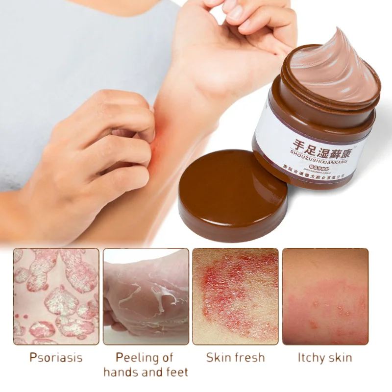 

Psoriasis Cream Herbal Pain Relief Ointment Hand and Feet Eczema Itchy Dermatitis Dermatitis Skin Care Skin Care Products