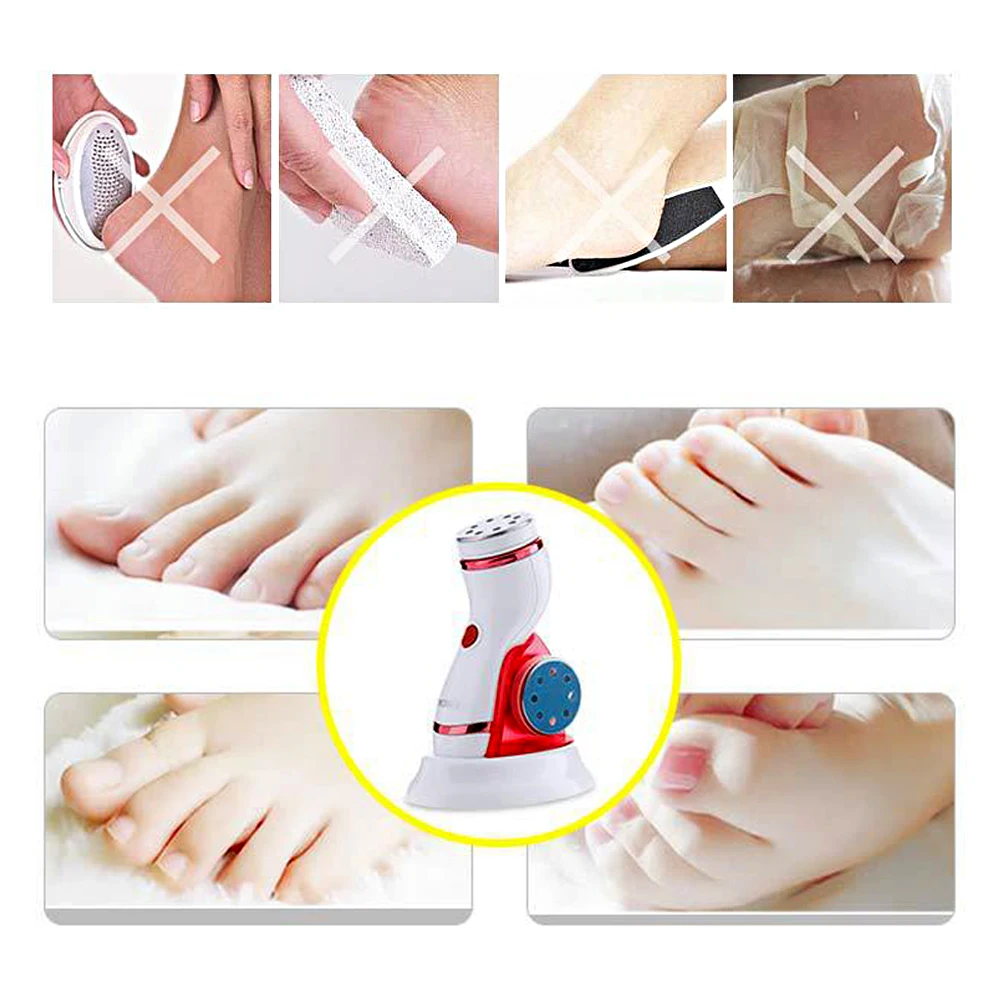 Электрический педикюр для ног средство восстановления омертвевшей кожи старый