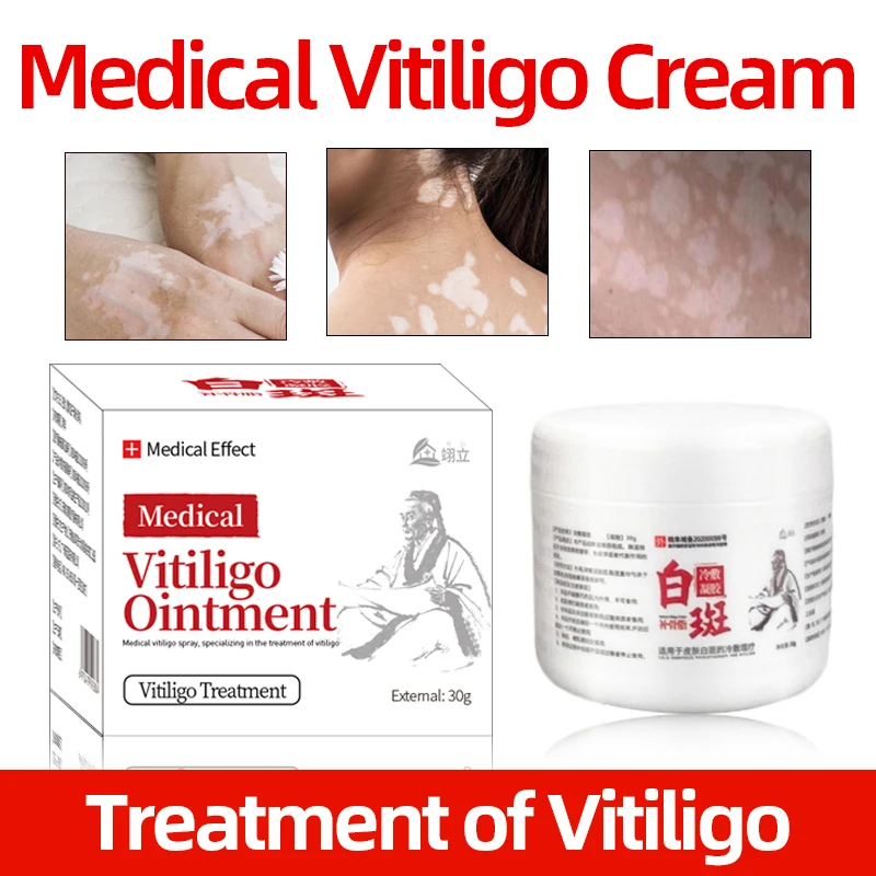 Крем для лечения винограда 30 г китайский медицинский пигмент продвижения