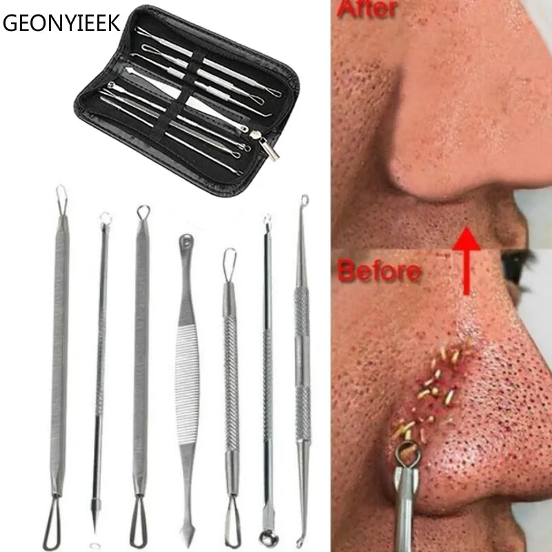 Набор инструментов для удаления черных точек набор из нержавеющей стали акне