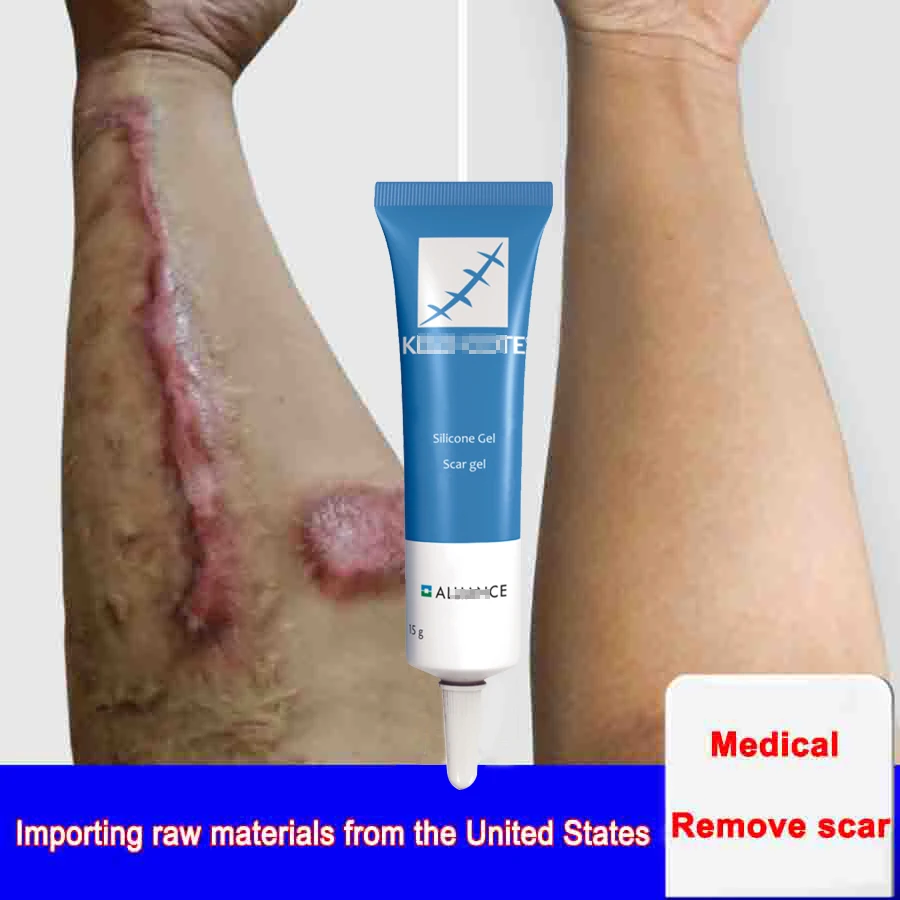 

15g Scar Removal Cream Face Cream For Face Acne Scar Stretch Marks Remover Cream Skin Repair Face Cream Acne Spots Ba Ke