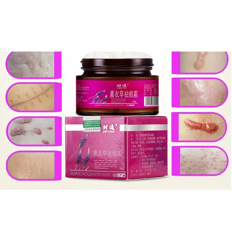 Крем для удаления шрамов от после беременности средство старых уход за телом 30