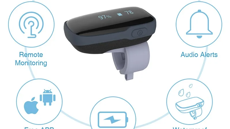 

Wellue Oxylink домашнее Медицинское беспроводное кольцо для измерения пульса