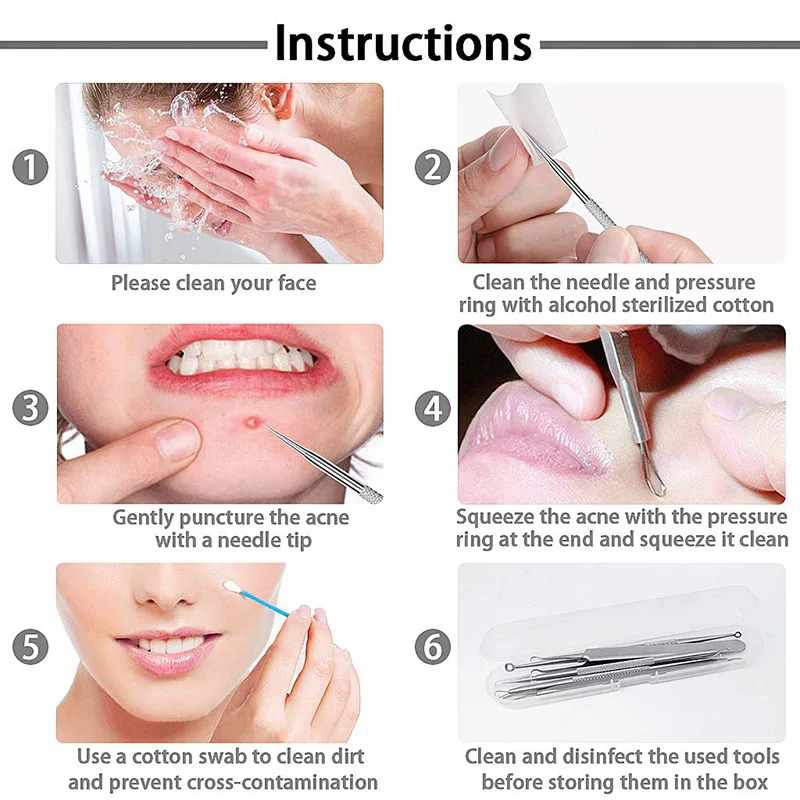 

5 Piece Tool Set for Blackhead Remover Acne Extractor Removal Tool for Acne Pimples SMJ