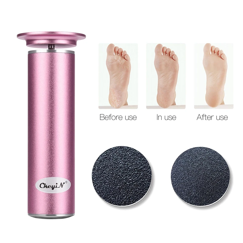 Педикюр Уход за ногами комплект скин для мозолей Remover Инструменты ног