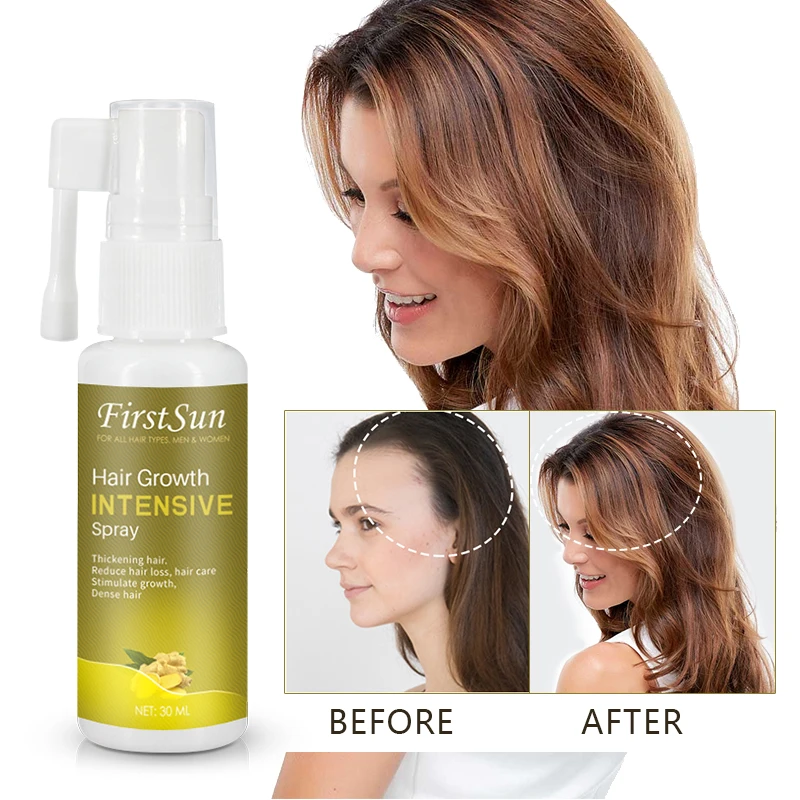 30 мл интенсивный спрей для роста волос натуральный экстракт женьшеня имбиря
