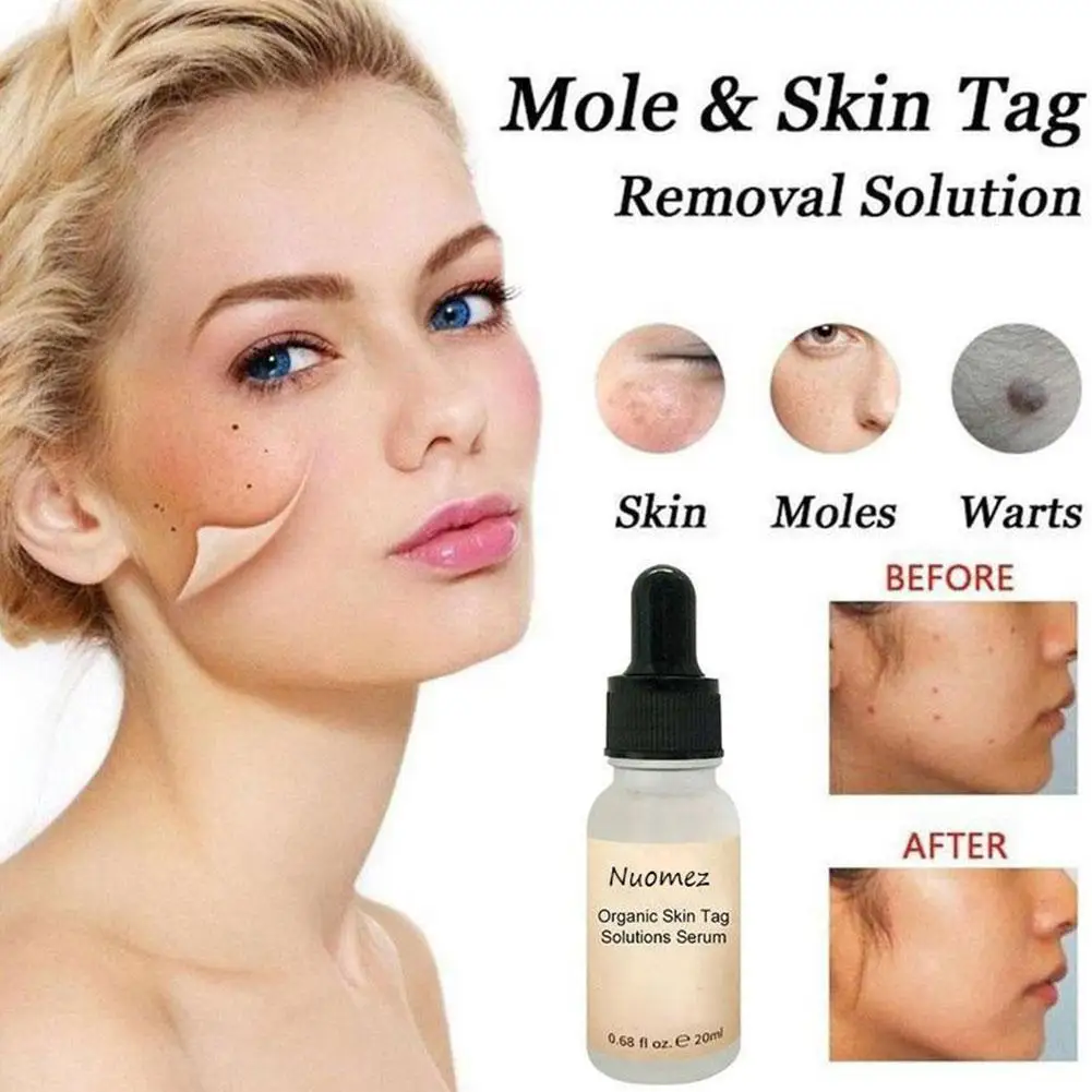 

20ml Organic Skin Spot Purifying Serum Natural Free Skin Tag Removal Mole Painless Odorless Repair Cream Care Freckle Z4P7